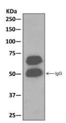 Immunoprecipitation - Anti-CRMP5 antibody [EPR13127(B)] - BSA and Azide free (AB249909), expandable thumbnail