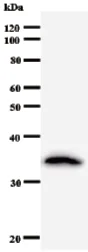 Western blot - Anti-CRNKL1 antibody [2212C1a] (AB51348)