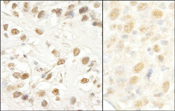 Immunohistochemistry (Formalin/PFA-fixed paraffin-embedded sections) - Anti-CROP antibody (AB80412)