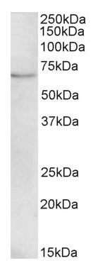 Western blot - Anti-CROT/COT antibody (AB175450), expandable thumbnail
