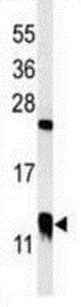 Western blot - Anti-CRP-1 antibody - C-terminal (AB211631)