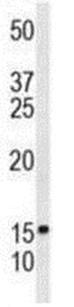 Western blot - Anti-CRP-1 antibody - C-terminal (AB211631)