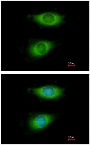 Immunocytochemistry/ Immunofluorescence - Anti-CRP-2 antibody (AB151496), expandable thumbnail