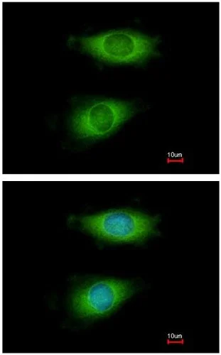 Immunocytochemistry/ Immunofluorescence - Anti-CRP-2 antibody (AB151496)