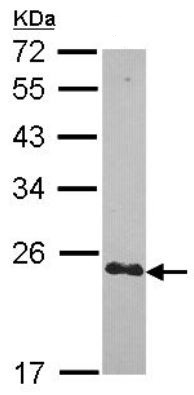 Western blot - Anti-CRP-2 antibody (AB151496), expandable thumbnail