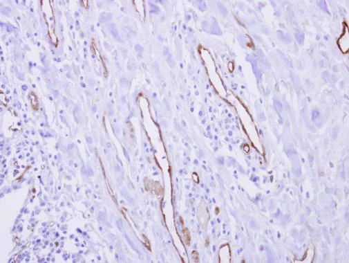 Immunohistochemistry (Formalin/PFA-fixed paraffin-embedded sections) - Anti-CRP-2 antibody (AB229110)