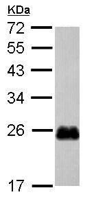 Western blot - Anti-CRP-2 antibody (AB229110)