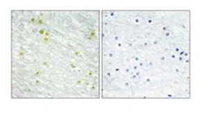 Immunohistochemistry (Formalin/PFA-fixed paraffin-embedded sections) - Anti-CRSP2 / MED14 antibody (AB196624)