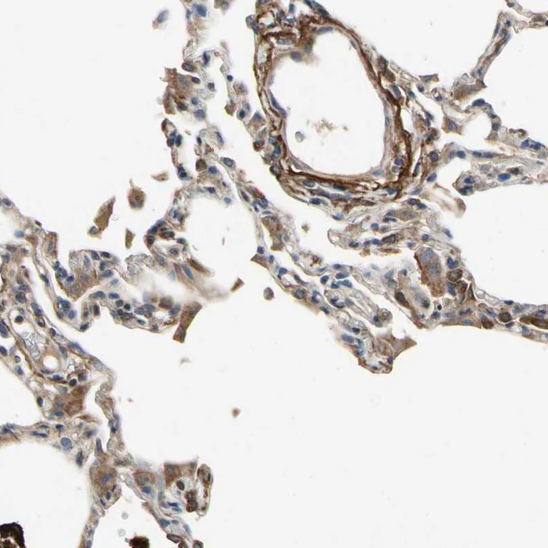 Immunohistochemistry (Formalin/PFA-fixed paraffin-embedded sections) - Anti-CRTAC1 antibody (AB254691)
