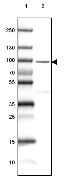 Western blot - Anti-CRTAC1 antibody (AB254691)
