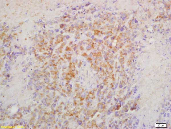 Immunohistochemistry (Formalin/PFA-fixed paraffin-embedded sections) - Anti-CRTAM antibody (AB214306)