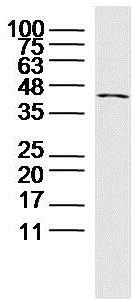 Western blot - Anti-CRTAM antibody (AB214306)
