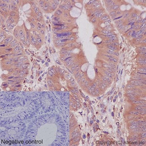 Immunohistochemistry (Formalin/PFA-fixed paraffin-embedded sections) - Anti-CRTAP/CASP antibody [EPR15121] - N-terminal (AB192261), expandable thumbnail