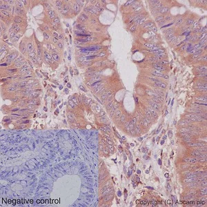 Immunohistochemistry (Formalin/PFA-fixed paraffin-embedded sections) - Anti-CRTAP/CASP antibody [EPR15121] - N-terminal (AB192261)