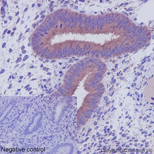 Immunohistochemistry (Formalin/PFA-fixed paraffin-embedded sections) - Anti-CRTAP/CASP antibody [EPR15121] - N-terminal (AB192261), expandable thumbnail