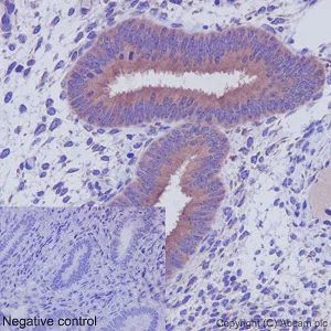 Immunohistochemistry (Formalin/PFA-fixed paraffin-embedded sections) - Anti-CRTAP/CASP antibody [EPR15121] - N-terminal (AB192261)