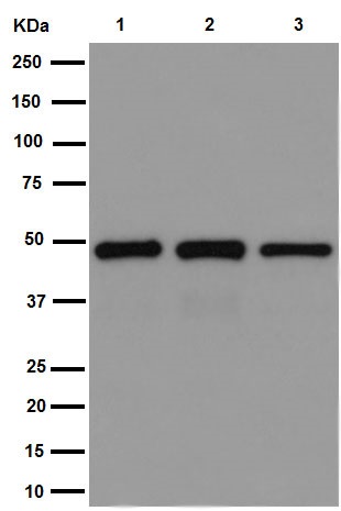 Western blot - Anti-CRTAP/CASP antibody [EPR15121] - N-terminal (AB192261), expandable thumbnail
