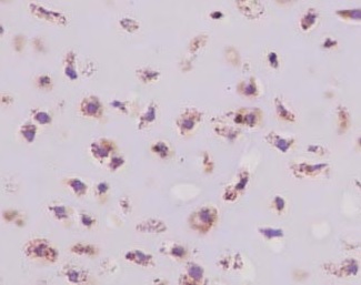 Immunohistochemistry (Formalin/PFA-fixed paraffin-embedded sections) - Anti-CRTAP/CASP antibody [EPR15122(B)] - BSA and Azide free (AB250694), expandable thumbnail