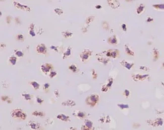 Immunohistochemistry (Formalin/PFA-fixed paraffin-embedded sections) - Anti-CRTAP/CASP antibody [EPR15122(B)] - BSA and Azide free (AB250694)