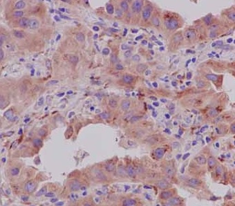 Immunohistochemistry (Formalin/PFA-fixed paraffin-embedded sections) - Anti-CRTAP/CASP antibody [EPR15122(B)] - BSA and Azide free (AB250694), expandable thumbnail