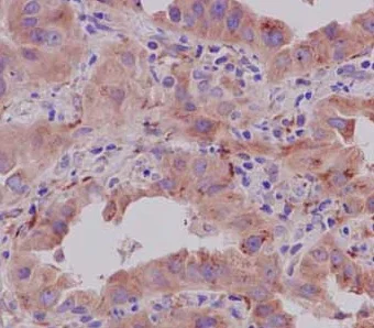 Immunohistochemistry (Formalin/PFA-fixed paraffin-embedded sections) - Anti-CRTAP/CASP antibody [EPR15122(B)] - BSA and Azide free (AB250694)
