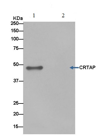 Immunoprecipitation - Anti-CRTAP/CASP antibody [EPR15122(B)] - BSA and Azide free (AB250694), expandable thumbnail