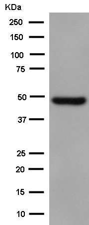 Western blot - Anti-CRTAP/CASP antibody [EPR15122(B)] - BSA and Azide free (AB250694), expandable thumbnail