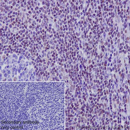 Immunohistochemistry (Formalin/PFA-fixed paraffin-embedded sections) - Anti-CRTC3 antibody [EPR3440] (AB91654), expandable thumbnail
