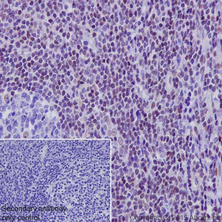 Immunohistochemistry (Formalin/PFA-fixed paraffin-embedded sections) - Anti-CRTC3 antibody [EPR3440] (AB91654)
