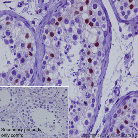 Immunohistochemistry (Formalin/PFA-fixed paraffin-embedded sections) - Anti-CRTC3 antibody [EPR3440] (AB91654), expandable thumbnail