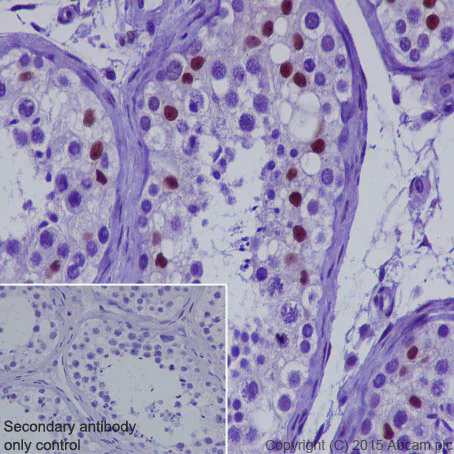 Immunohistochemistry (Formalin/PFA-fixed paraffin-embedded sections) - Anti-CRTC3 antibody [EPR3440] (AB91654)