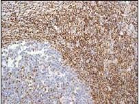Immunohistochemistry (Formalin/PFA-fixed paraffin-embedded sections) - Anti-CRTC3 antibody [EPR3440] (ab91654), expandable thumbnail
