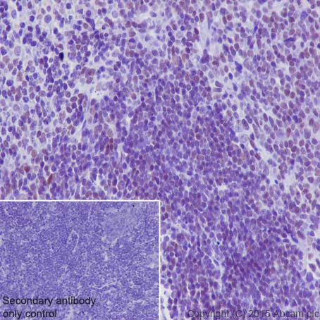 Immunohistochemistry (Formalin/PFA-fixed paraffin-embedded sections) - Anti-CRTC3 antibody [EPR3440] - BSA and Azide free (AB220809)