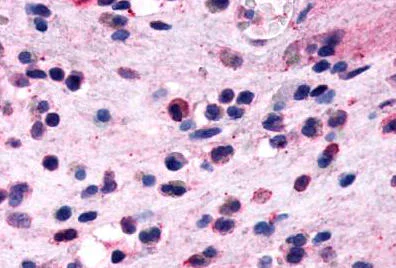 Immunohistochemistry (Formalin/PFA-fixed paraffin-embedded sections) - Anti-CRTH2 antibody (AB150632)