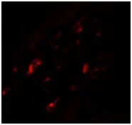 Immunocytochemistry/ Immunofluorescence - Anti-CRTH2 antibody (AB190506)
