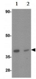 Western blot - Anti-CRTH2 antibody (AB190506)
