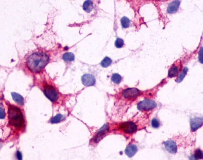 Immunocytochemistry - Anti-CRTH2 antibody - N-terminal (AB188998)