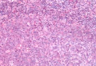 Immunohistochemistry (Formalin/PFA-fixed paraffin-embedded sections) - Anti-CRTH2 antibody - N-terminal (AB188998)