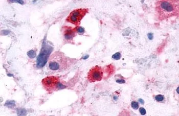 Immunohistochemistry (Formalin/PFA-fixed paraffin-embedded sections) - Anti-CRTH2 antibody - N-terminal (AB188998)