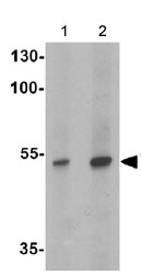 Western blot - Anti-CRTR1 antibody (AB140197), expandable thumbnail