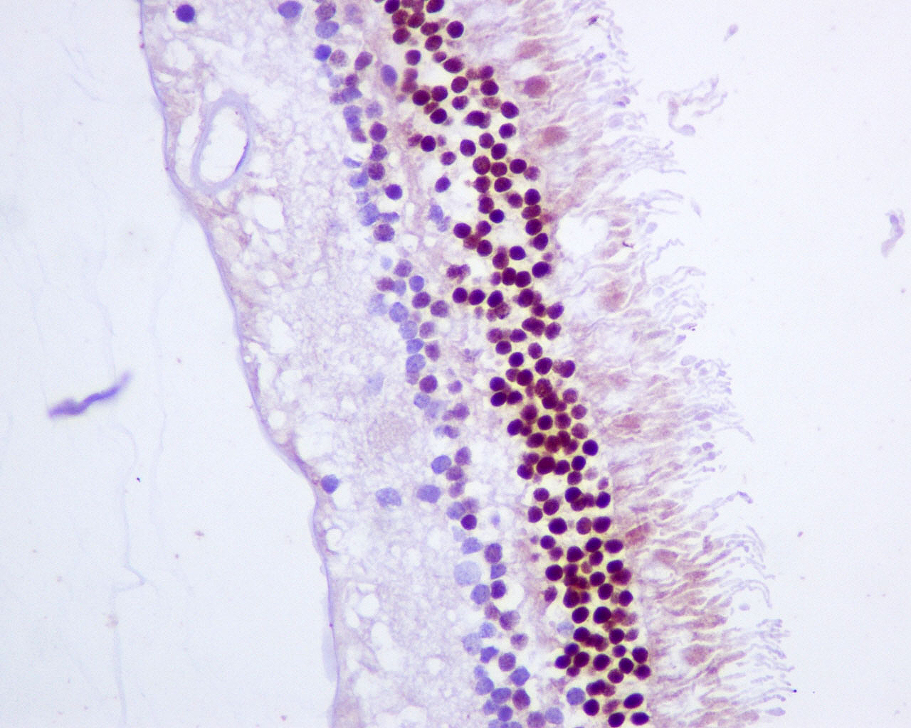 Immunohistochemistry (Formalin/PFA-fixed paraffin-embedded sections) - Anti-CRX antibody [EPR9582] (AB140603), expandable thumbnail