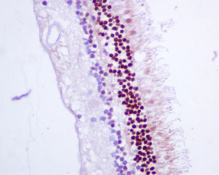 Immunohistochemistry (Formalin/PFA-fixed paraffin-embedded sections) - Anti-CRX antibody [EPR9582] (AB140603)