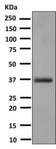 Western blot - Anti-CRX antibody [EPR9582] (AB140603), expandable thumbnail