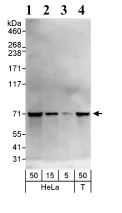 Western blot - Anti-CRY2 antibody (AB93802)