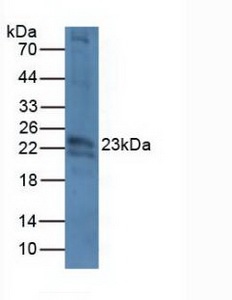 Western blot - Anti-CRYBB2 antibody (AB232832), expandable thumbnail