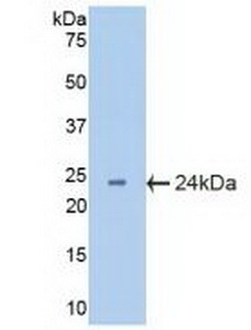 Western blot - Anti-CRYBB2 antibody (AB232832), expandable thumbnail