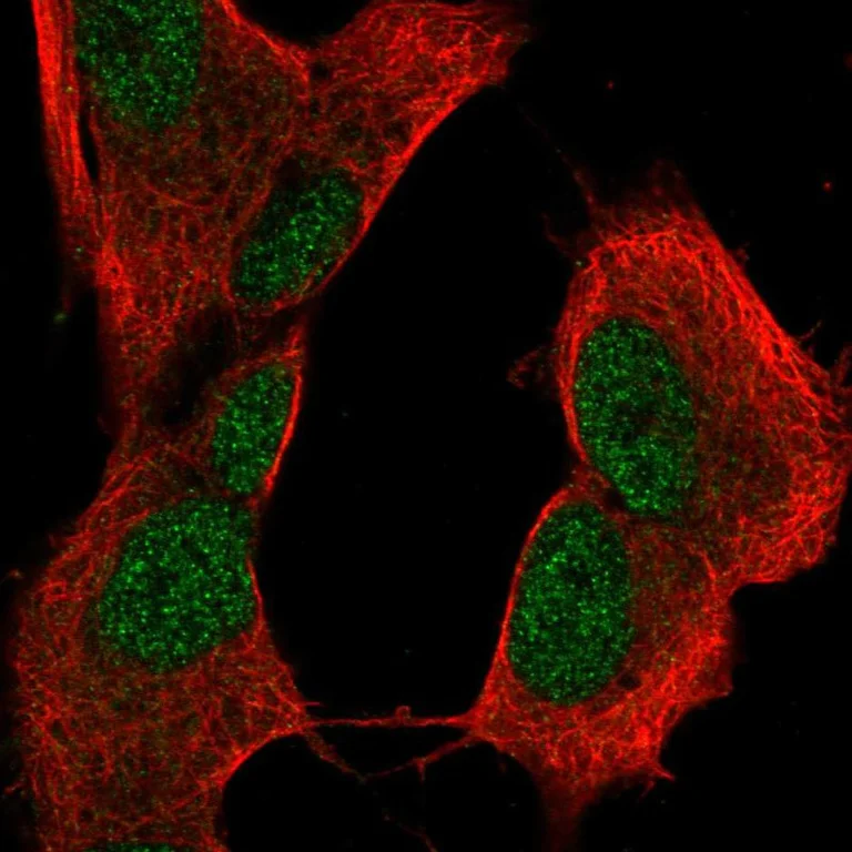 Immunocytochemistry/ Immunofluorescence - Anti-CRYBB2 antibody (AB252971)