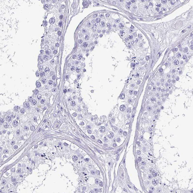 Immunohistochemistry (Formalin/PFA-fixed paraffin-embedded sections) - Anti-CRYBB2 antibody (AB252971)