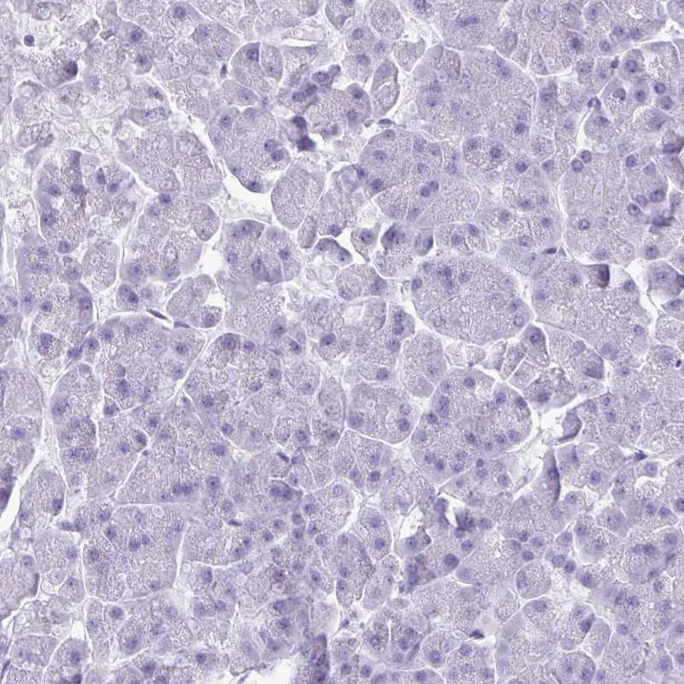 Immunohistochemistry (Formalin/PFA-fixed paraffin-embedded sections) - Anti-CRYBB2 antibody (AB252971)
