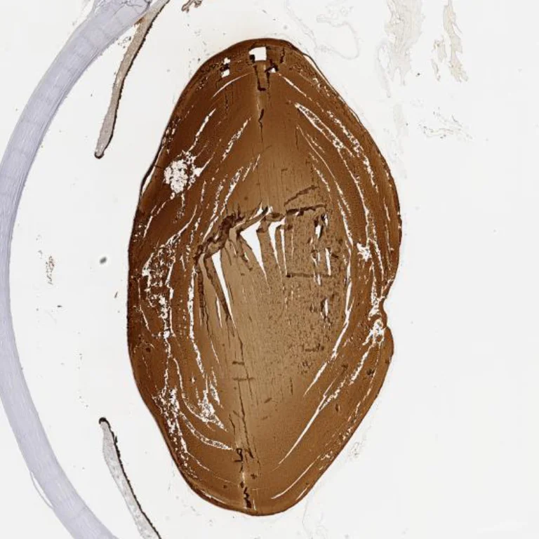 Immunohistochemistry (Formalin/PFA-fixed paraffin-embedded sections) - Anti-CRYBB2 antibody (AB252971)